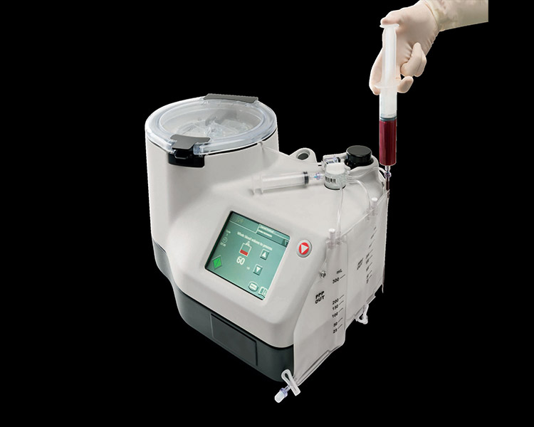 カスタムメイドPRP療法